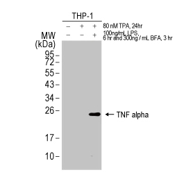 TNF alpha antibody [HL1579] (GTX637058)