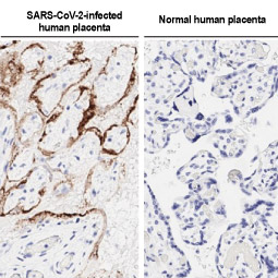 SARS-CoV-2 (COVID-19) Nucleocapsid antibody [HL344] (GTX635679)