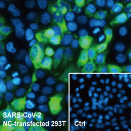 SARS-CoV-2 (COVID-19) Nucleocapsid antibody [HL5511] (GTX635689)