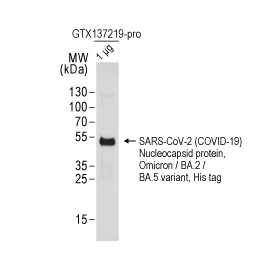 SARS-CoV-2 (COVID-19) Nucleocapsid protein, Omicron / BA.2 / BA.5 variant, His tag (GTX137219-pro)