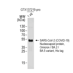 SARS-CoV-2 (COVID-19) Nucleocapsid protein, Omicron / BA.2 / BA.5 variant, His tag (GTX137219-pro)