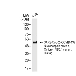 SARS-CoV-2 (COVID-19) Nucleocapsid protein, Omicron / BQ.1 variant, His tag (GTX137883-pro)