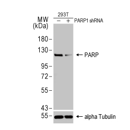 PARP antibody [HL1365] (GTX636805)
