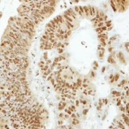 ANP32B antibody (GTX115437)