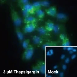 SQSTM1 / P62 antibody [HL1113] (GTX636328)