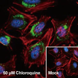 LC3B antibody (GTX127375)