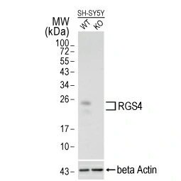 RGS4 antibody [HL1522] (GTX636996)