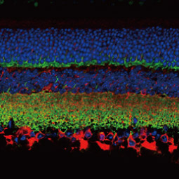 Synaptophysin antibody (GTX100865)