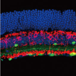 Calretinin antibody (GTX103261)