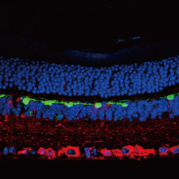 Calbindin antibody (GTX130856)