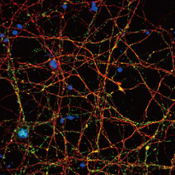 VGluT1 antibody (GTX133148)