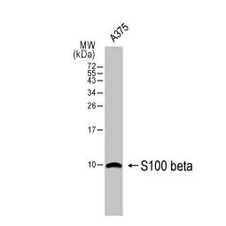 Detection of S100 beta in A375 (malignant melanoma) cell lysate.