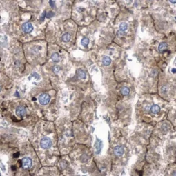 SRGAP2 antibody (GTX130797)