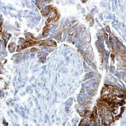 EGFR antibody [GT133] (GTX628887)