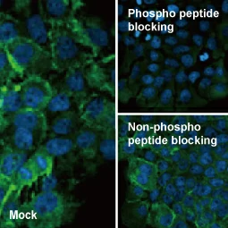 Her2 / ErbB2 (phospho Tyr1248) antibody [HL1466] (GTX636940)