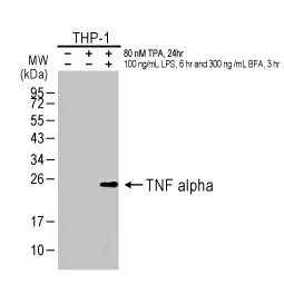 TNF alpha antibody [HL1579] (GTX637058)