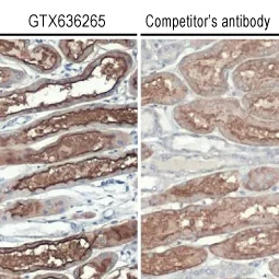 ACE2 antibody [HL1092] (GTX636265)