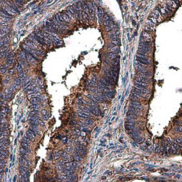 MMP2 antibody (GTX104577)