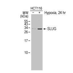 SLUG antibody (GTX128796)