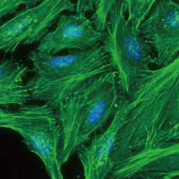 beta Actin antibody (GTX109639) 