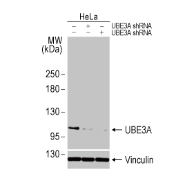 UBE3A antibody [HL1660] (GTX637258)