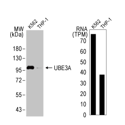 UBE3A antibody [HL1660] (GTX637258)