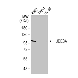 UBE3A antibody [HL1660] (GTX637258)