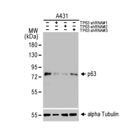 p63 antibody [N2C1], Internal (GTX102425)