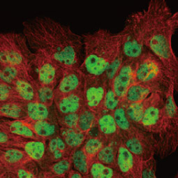 p63 antibody [HL1027] (GTX635841)