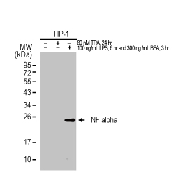 TNF alpha antibody [HL1579] (GTX637058)