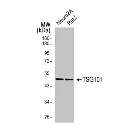 TSG101 antibody (GTX118736)
