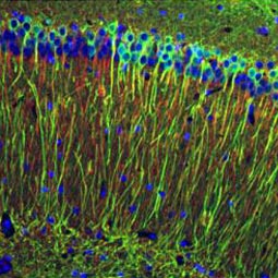 Tau antibody (GTX130462)