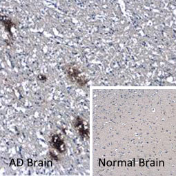 beta amyloid (1-42) antibody-Conformation Specific (GTX134510)