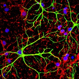 GFAP antibody (GTX108711) 