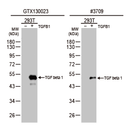 TGF beta 1 antibody (GTX130023)