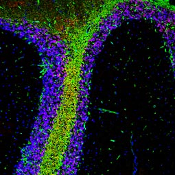 ALDH1L1 antibody (GTX131047)