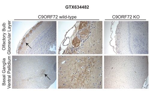 Analysis of C9ORF72 antibody (GTX634482) on C9ORF72 knockout mouse tissue by immunohistochemistry