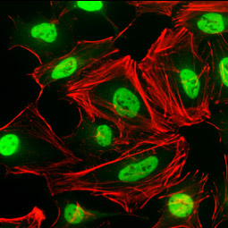 MAFG antibody (GTX114541)