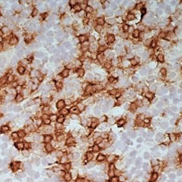 CD8 antibody [LT8] (GTX74773)