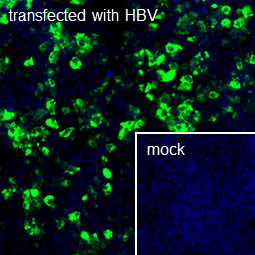 HBV Surface Antigen antibody [S26] (GTX41800)