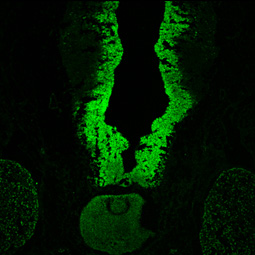 SOX2 antibody [N1C3] (GTX101507) 