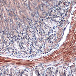 alpha Smooth Muscle Actin antibody [GT445] (GTX629702)