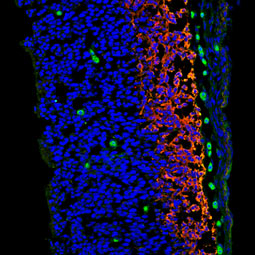 Vimentin antibody [GT812] (GTX629744)