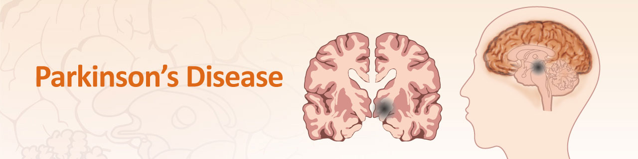 Clinical trials targeting alpha-synuclein protein in Parkinson’s disease 
