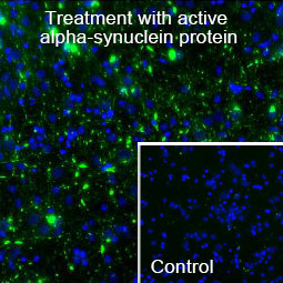 Rat primary hippocampal neurons were treated with active α-synuclein protein (GTX17669-pro) and examined by immunostaining.