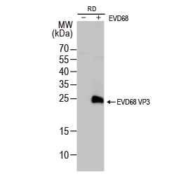 Enterovirus D68 VP3 antibody (GTX132315)