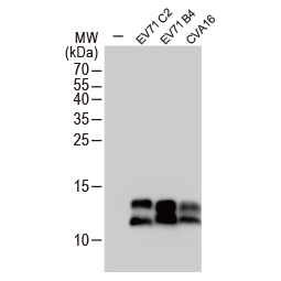 Enterovirus 71 3AB (GTX132344)