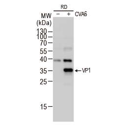 Coxsackievirus A6 VP1 antibody (GTX132346)
