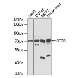 SETD3 antibody (GTX65538)