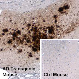 beta Amyloid (1-42) antibody – Conformation Specific (GTX134510)